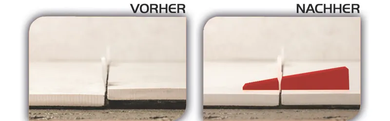 Heka Nivofix Basisset 2,0 mm (100 Laschen, 100 Keile, 1 Zange) 4