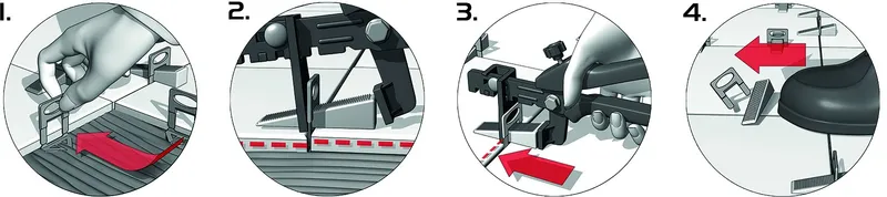 Heka Nivofix Basisset 2,0 mm (100 Laschen, 100 Keile, 1 Zange) 5